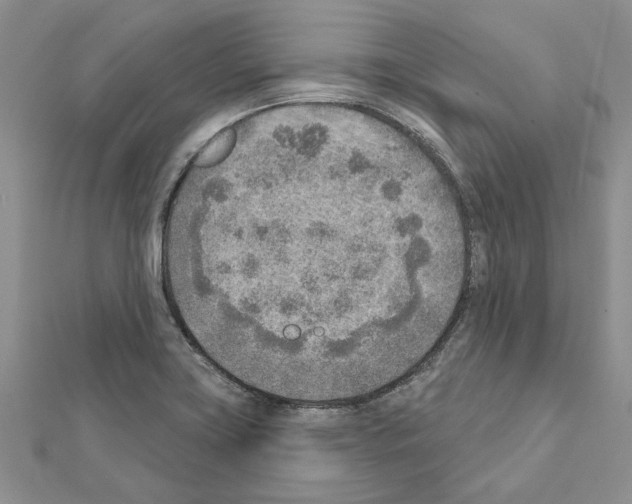 X0000111621419200908281103