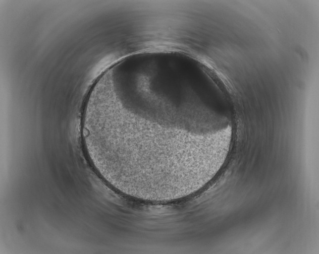 X0000111621459200908281102