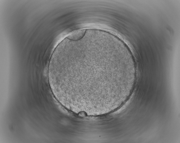 X0000111621529200908281102