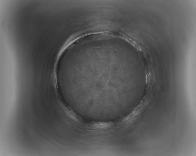 X0000111630198200907171533