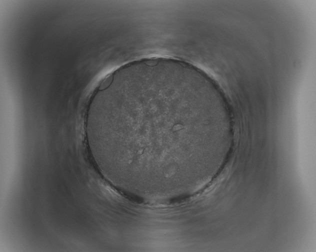 X0000111631359200907171518