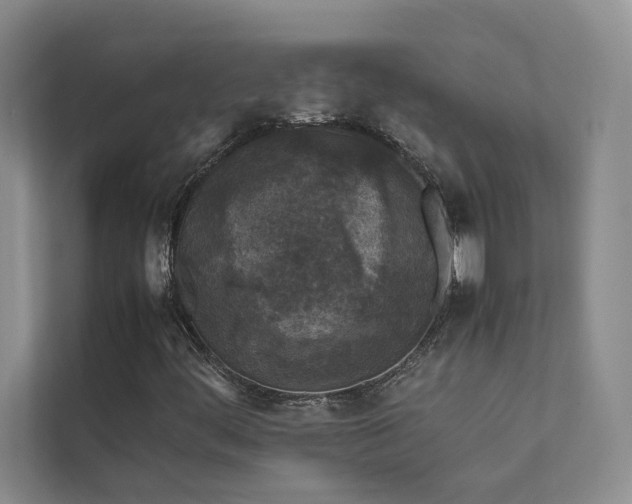 X0000111631444200907171517