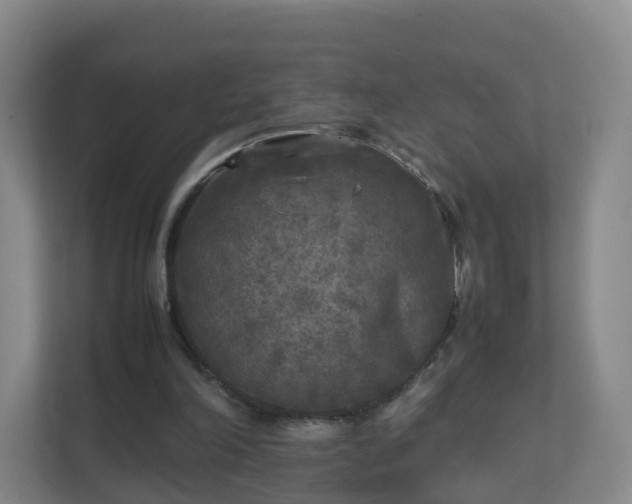 X0000111630198200907241057