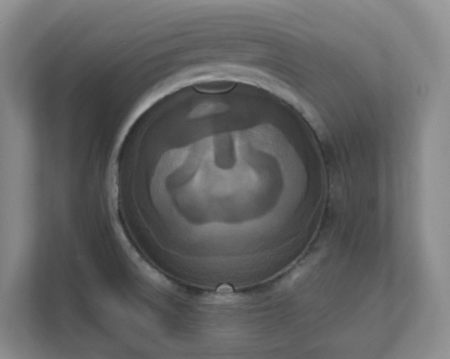 X0000111631522200907241040