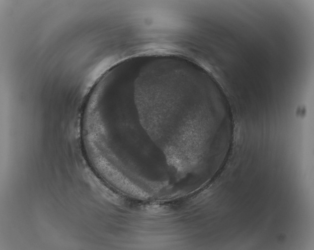 X0000111631459200907311215