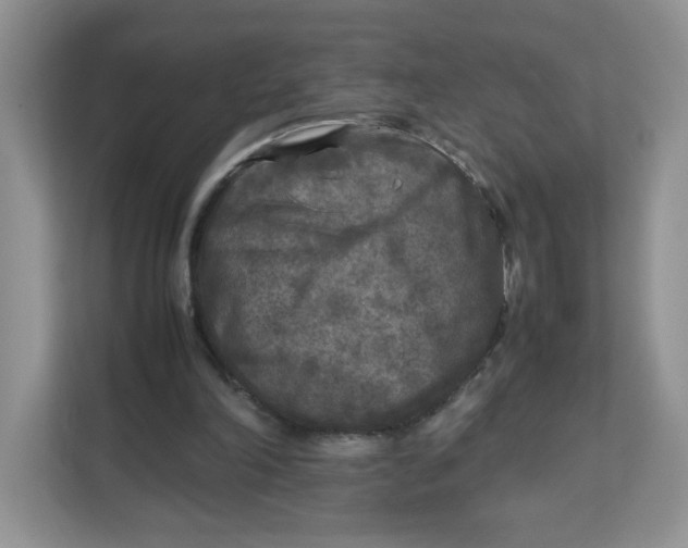 X0000111630198200908071418