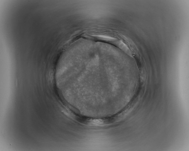 X0000111630409200908071415