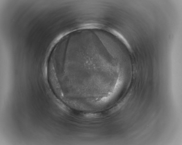 X0000111631419200908071402