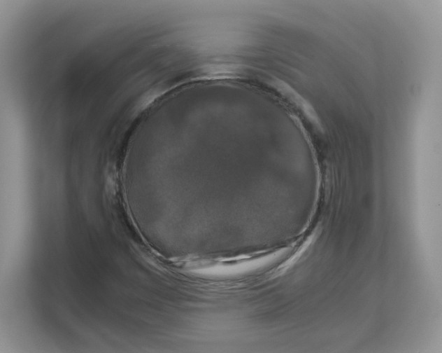 X0000111631449200908071401