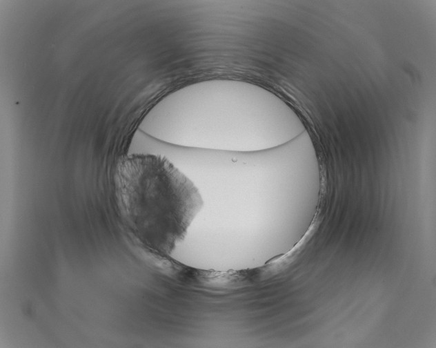 X0000111640191200907171046