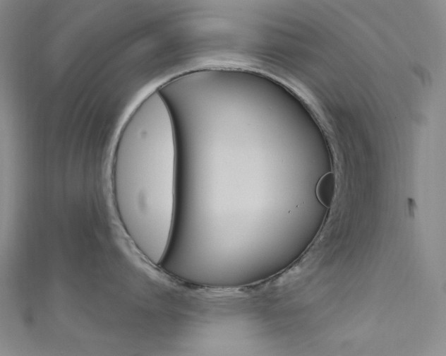 X0000111640864200907171037