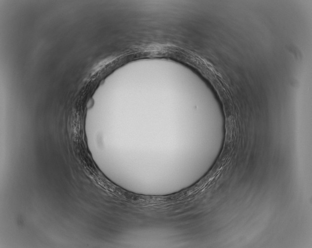 X0000111641158200907171032
