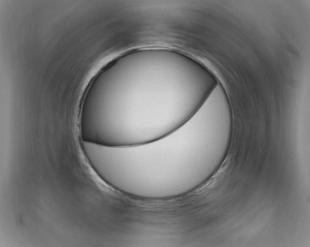 X0000111641485200907171028