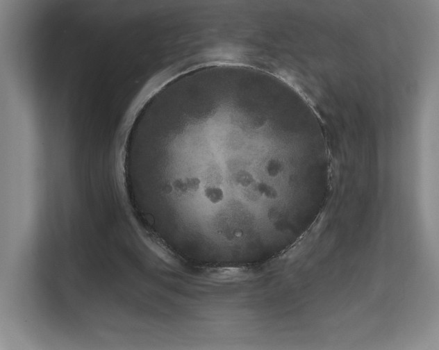 X0000111640151200907171554