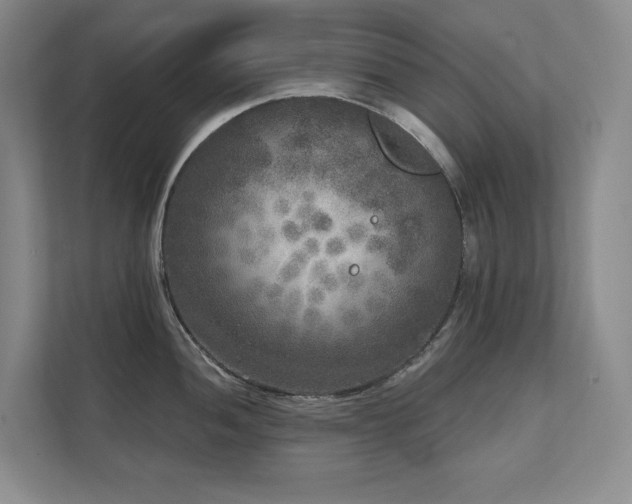 X0000111641052200907171543