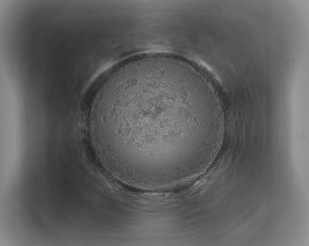 X0000111641255200907171540