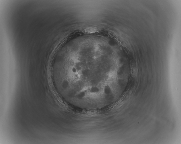 X0000111641393200907171537