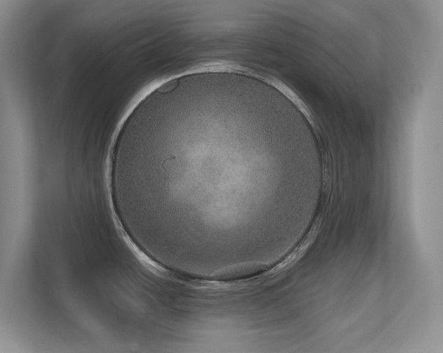 X0000111641438200907171538