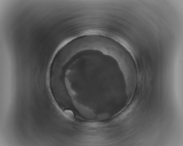 X0000111641045200907241107