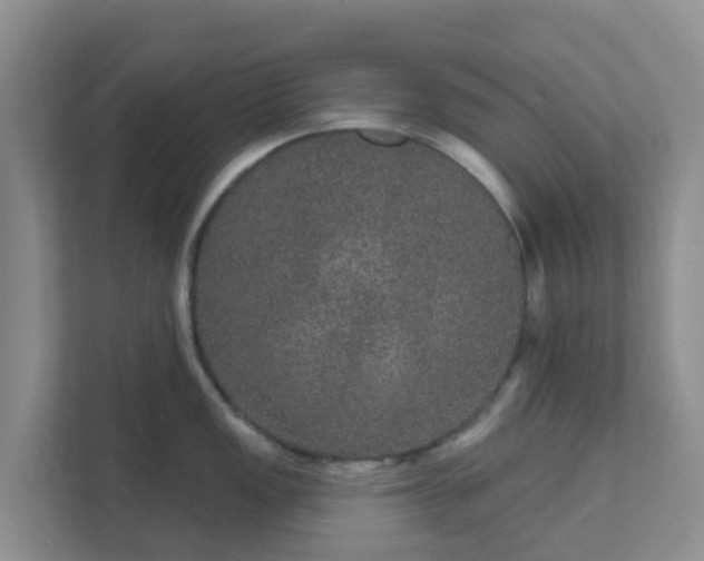 X0000111641149200907241105