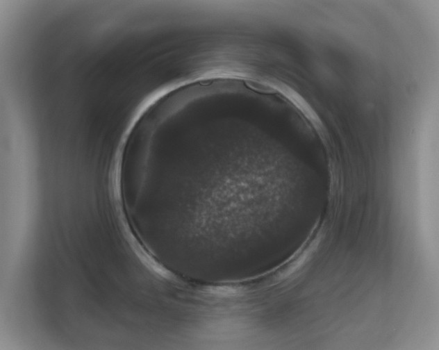 X0000111641246200907241104