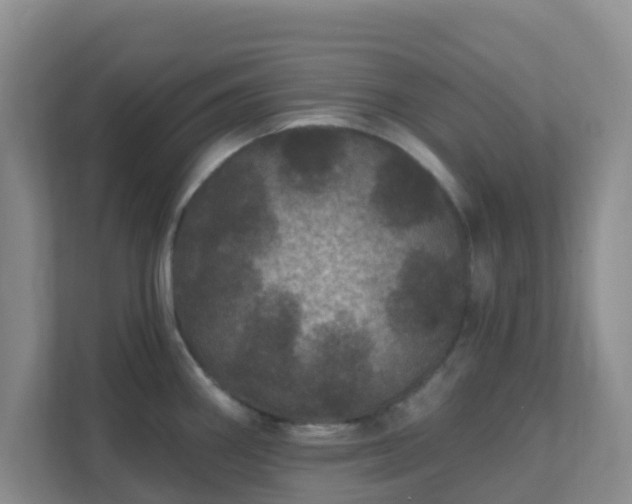 X0000111641290200907241103