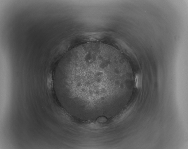 X0000111641395200907241101