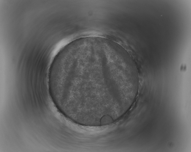 X0000111640006200908141418