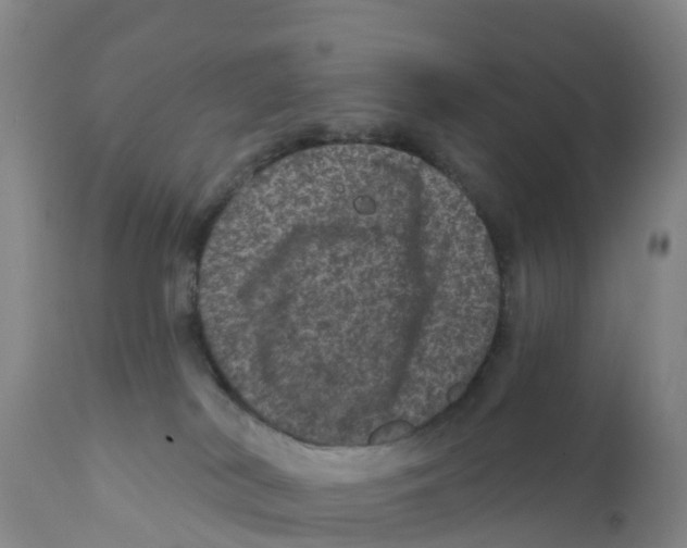 X0000111640038200908141418