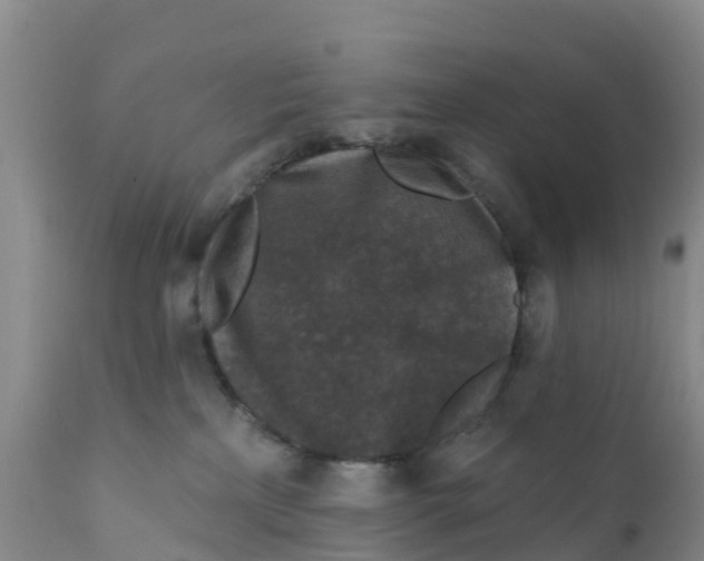 X0000111640233200908141415