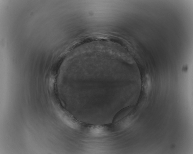 X0000111640235200908141415