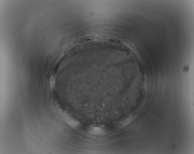X0000111640285200908141415