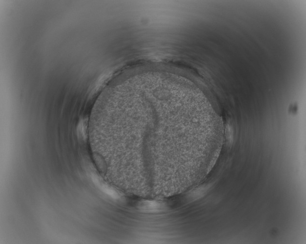 X0000111640286200908141415