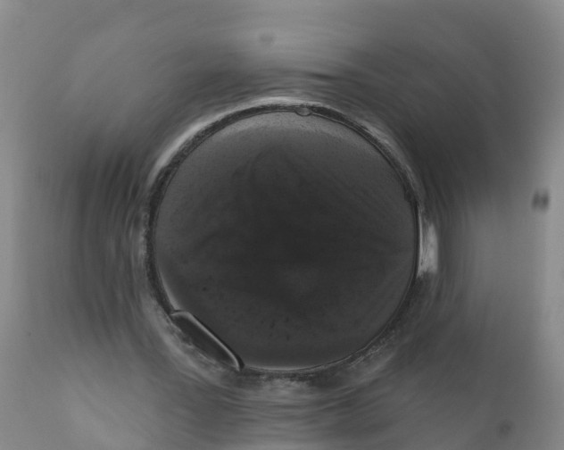 X0000111640387200908141413
