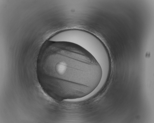 X0000111640577200908141409