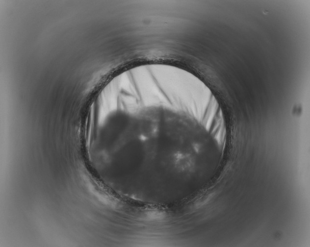 X0000111640592200908141409
