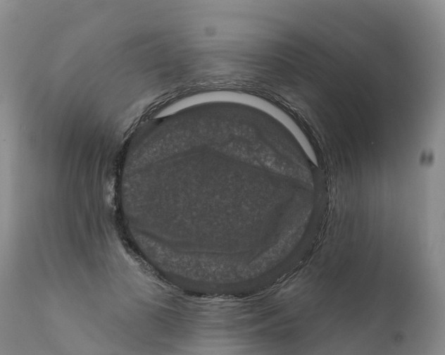 X0000111640693200908141407