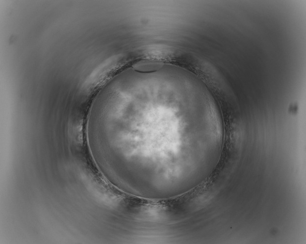 X0000111640696200908141407