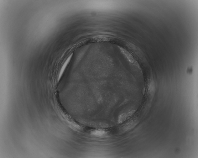 X0000111640759200908141407