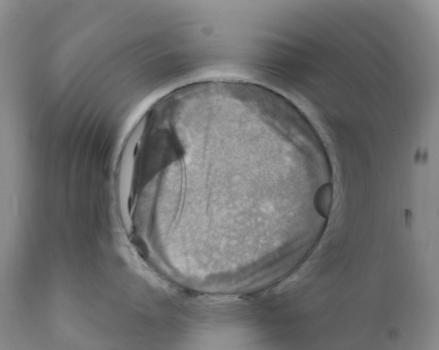 X0000111640864200908141405