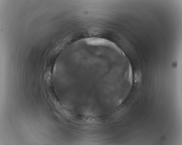 X0000111641011200908141402