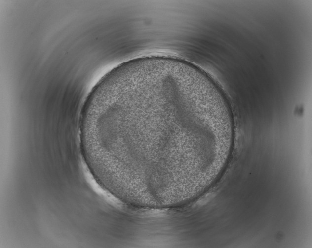 X0000111641038200908141402