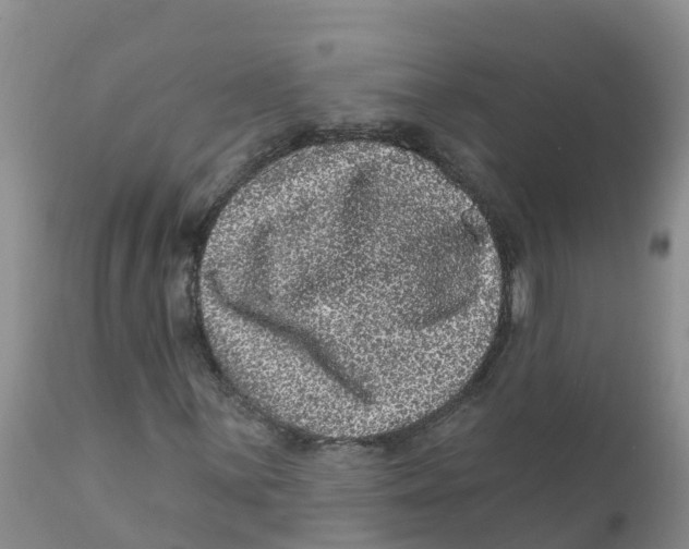 X0000111641059200908141402