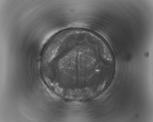 X0000111641115200908141400