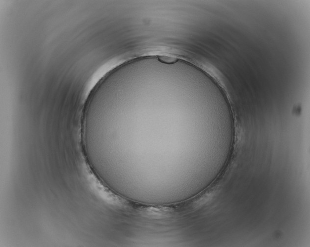 X0000111641138200908141401