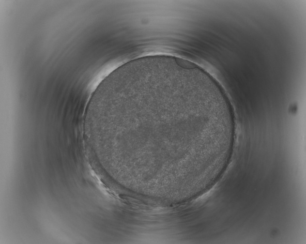 X0000111641145200908141401