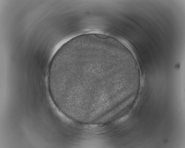 X0000111641149200908141401