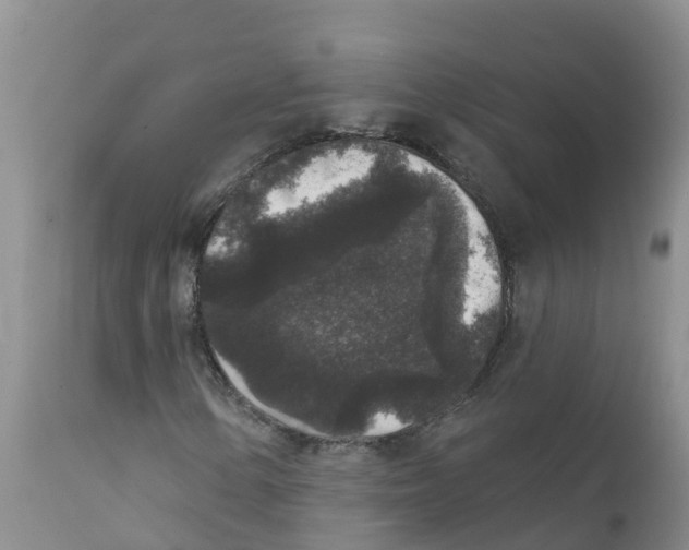 X0000111641154200908141400