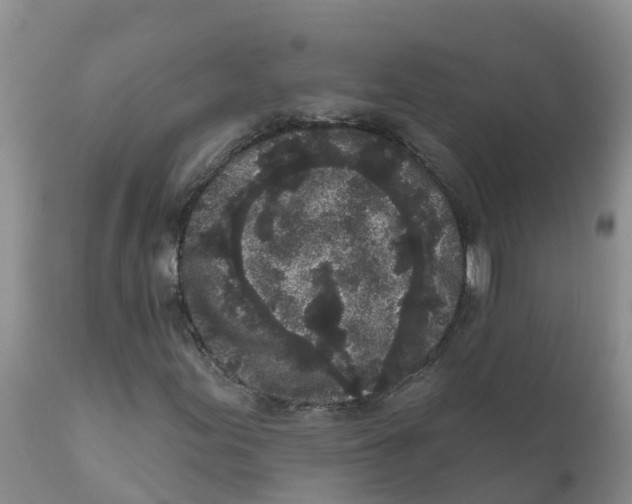 X0000111641155200908141400