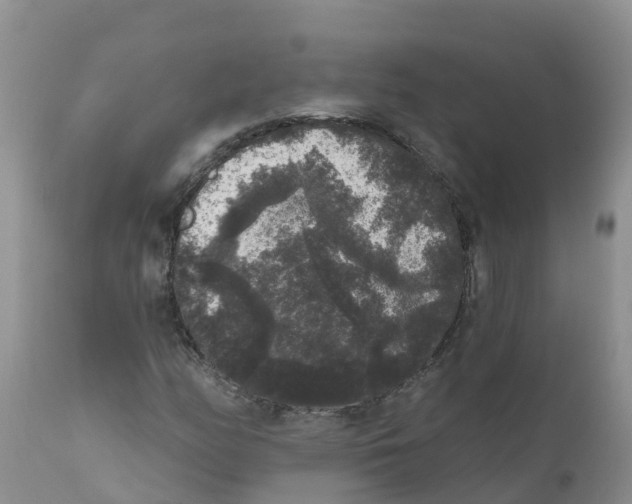X0000111641158200908141400